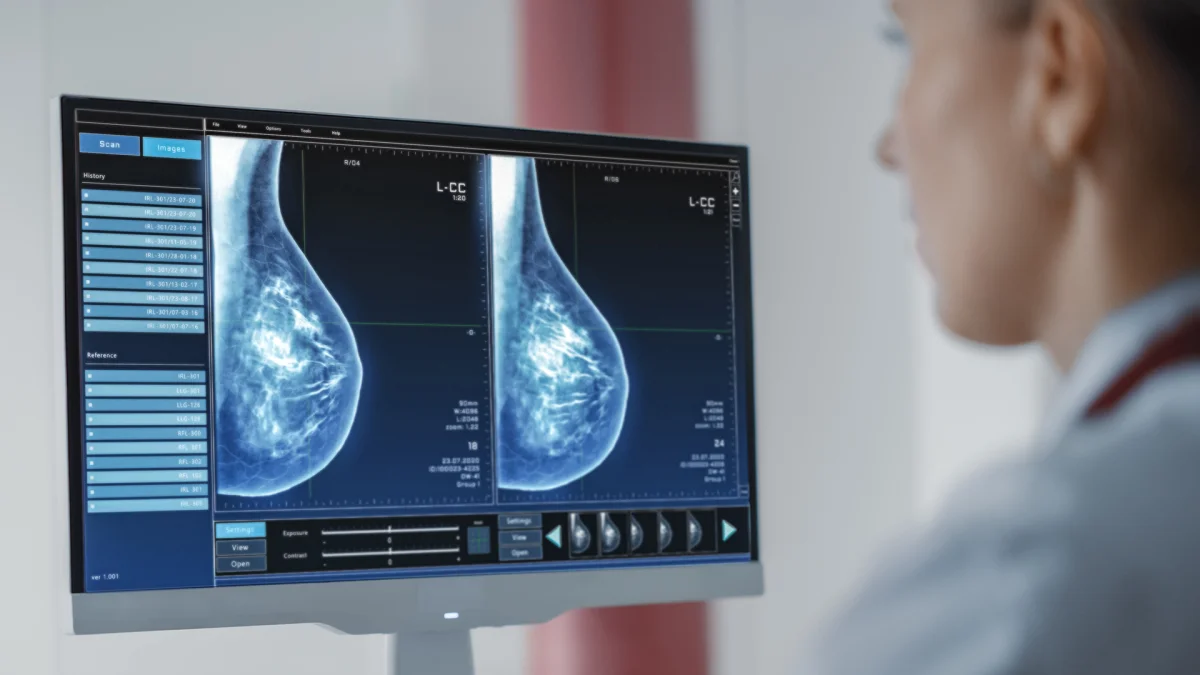 AI Innovations Target Breast Cancer Care Gaps from Screening to Treatment